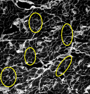 Mikorskopiering af yderl�r