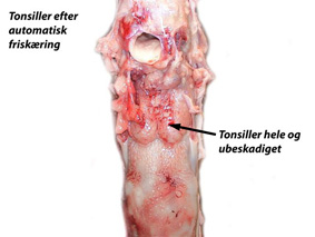 Tonsillerne er hele og ubeskadiget efter automatisk udtagning
