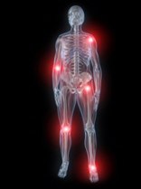 Skelet - Proteser - Infektioner og smerter