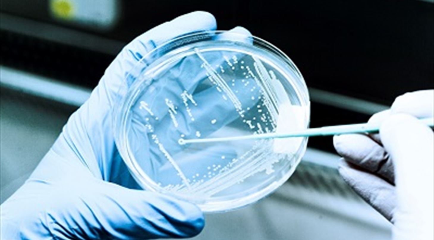 Mikrobiologisk analyse