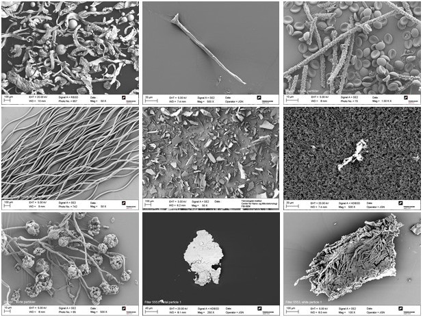 kollage af SEM billeder der viser partikler