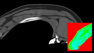 figur 1 - DMRI