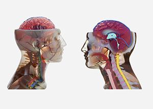 Anatomiske modeller af hoveder