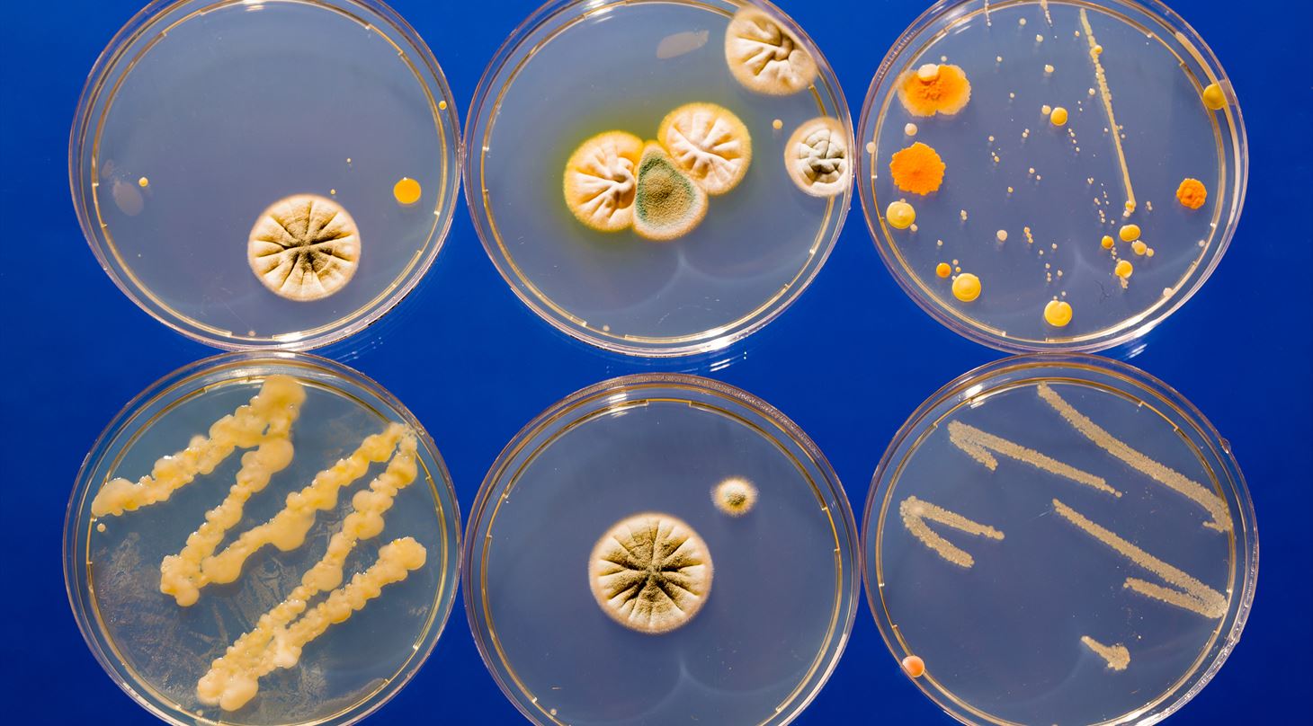Kemisk analyse af toksinet cereulid fra Bacillus cereus